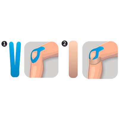 Zestaw gotowych aplikacji na kolano -  (AcuTop Precut Knee)