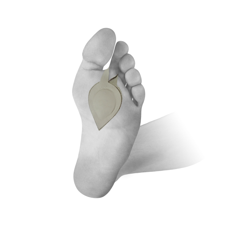 Pelota ortopedyczna na płaskostopie poprzeczne - z mocowaniem na palec (U-MED)