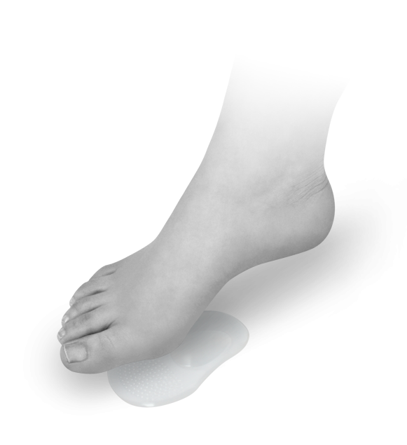 Żelowa pół-wkładka metatarsalna na płaskostopie poprzeczne (step gel)